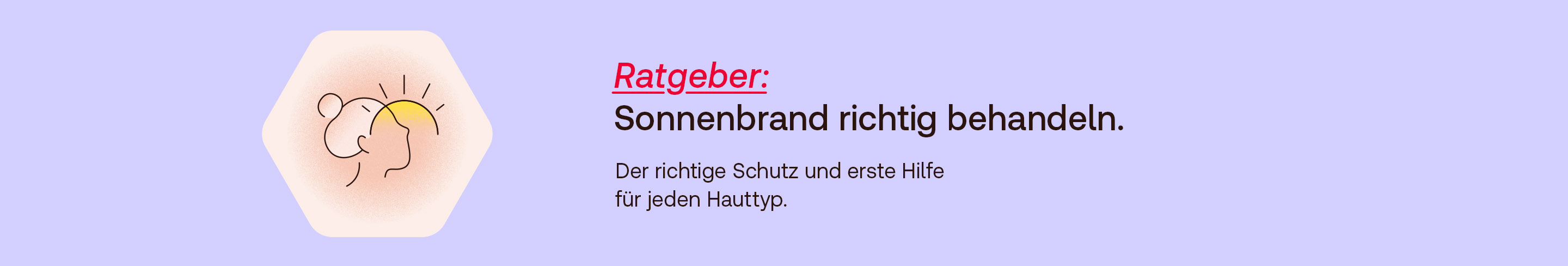 Sonnenbrand Ratgeber